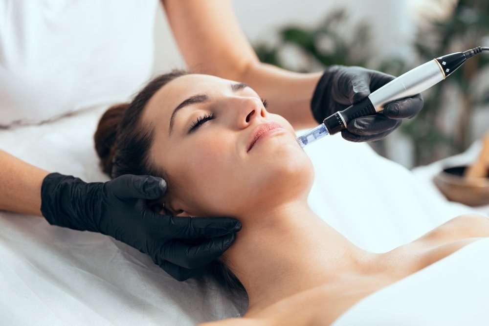 Microneedling facial procedure being performed
